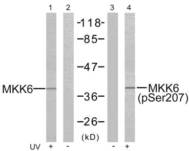 MKK6 (Phospho-Ser207) Antibody