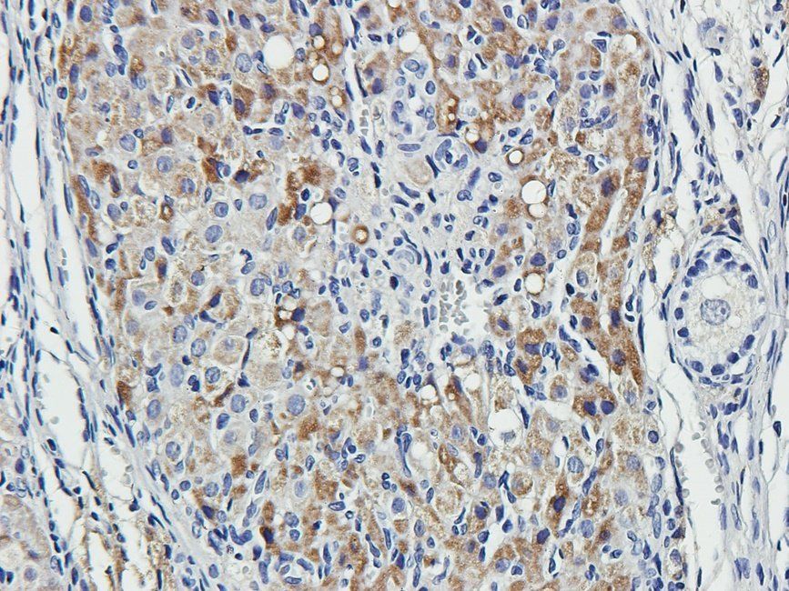 MKLP1 antibody