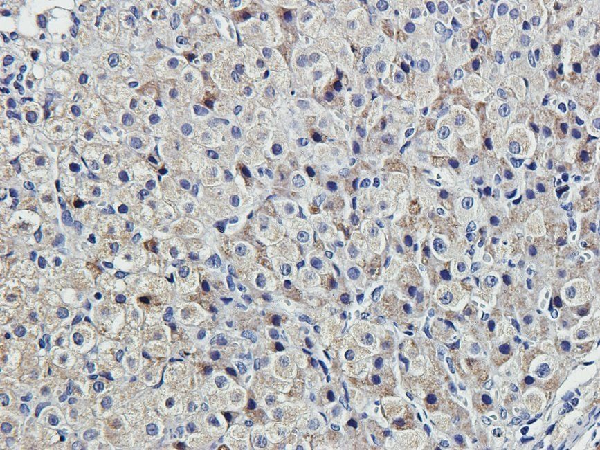 MKLP1 antibody