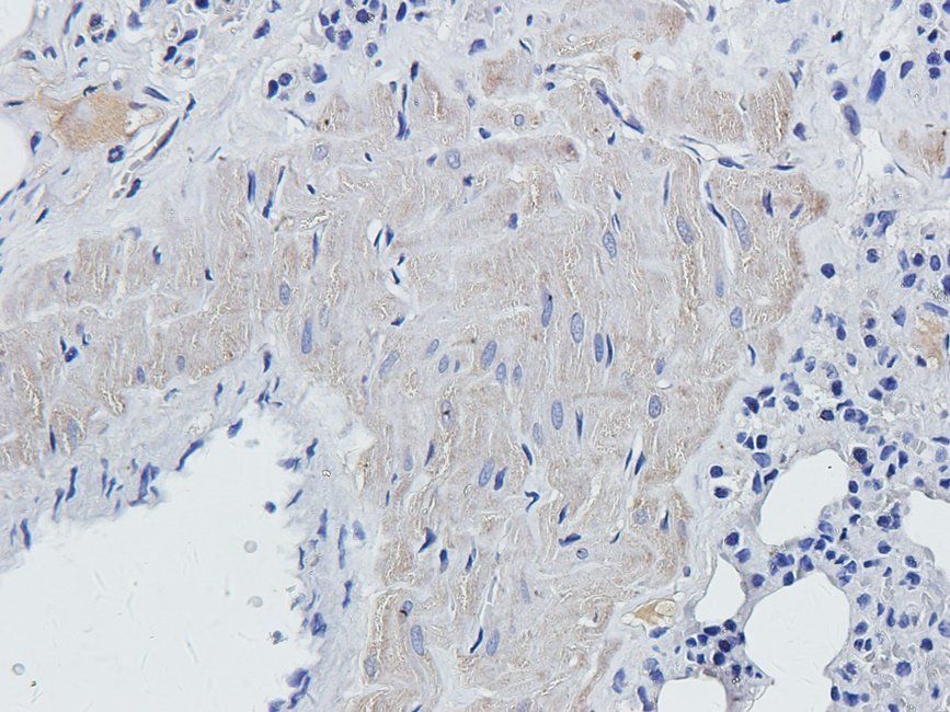 MKLP1 antibody