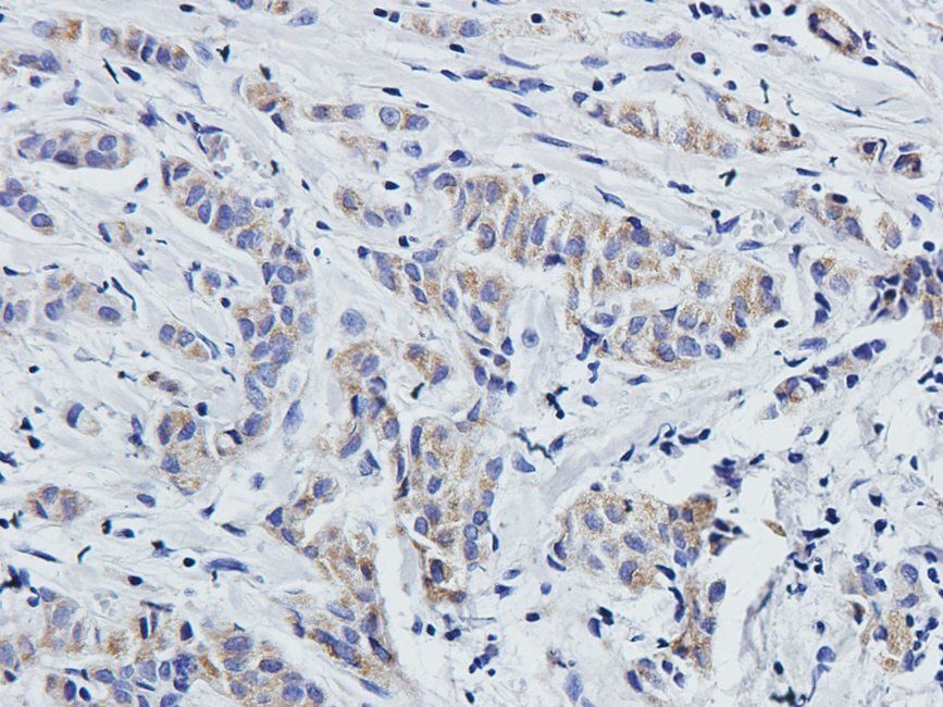 MKLP1 antibody