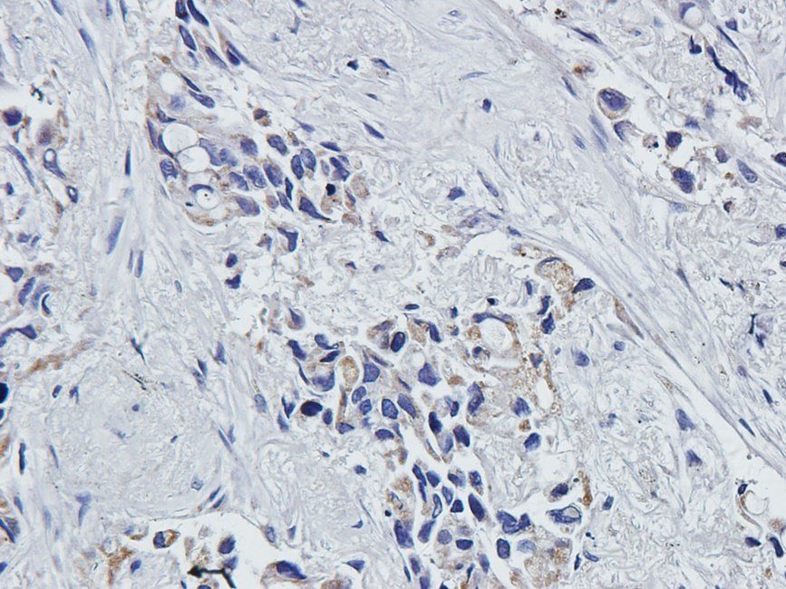 MKLP1 antibody