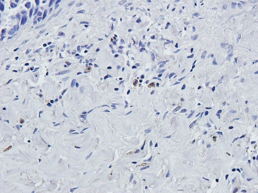 MKLP1 antibody