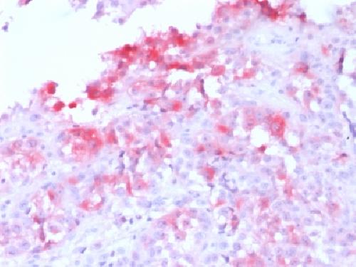 Recombinant MART-1 / Melan-A / MLANA (Melanoma Marker) Antibody