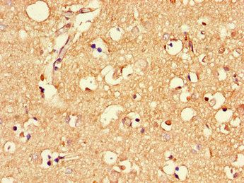 MLC1 Antibody