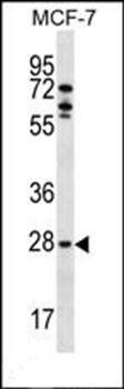 MLF1 antibody