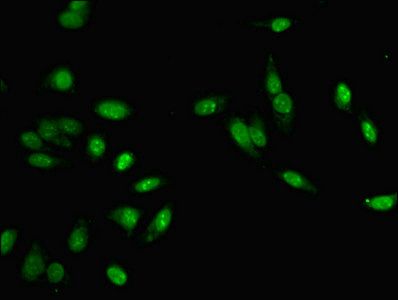 MLH1 Antibody