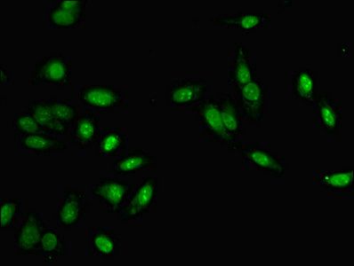 MLH1 antibody