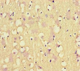 MLH1 Antibody
