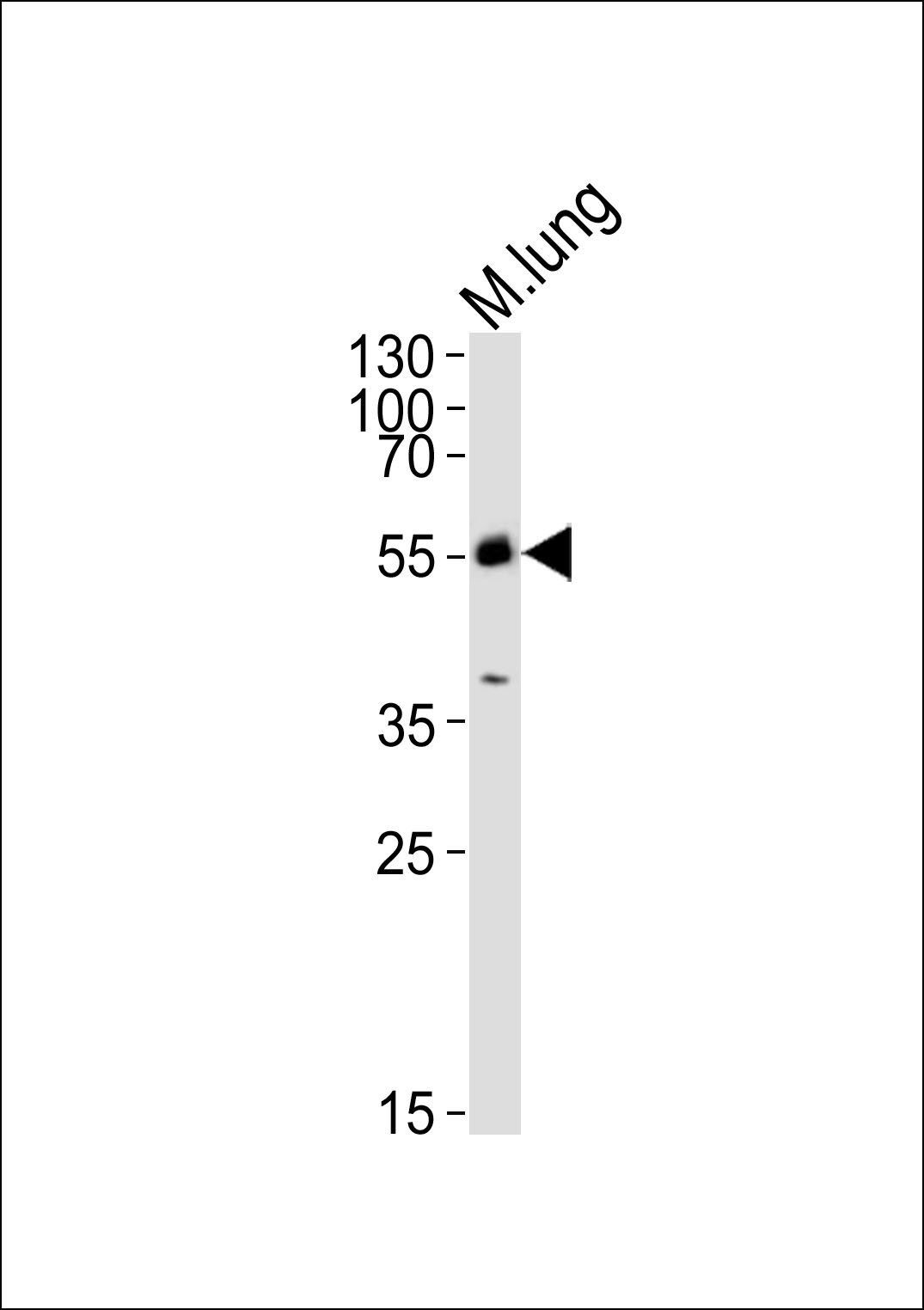 Mlkl antibody