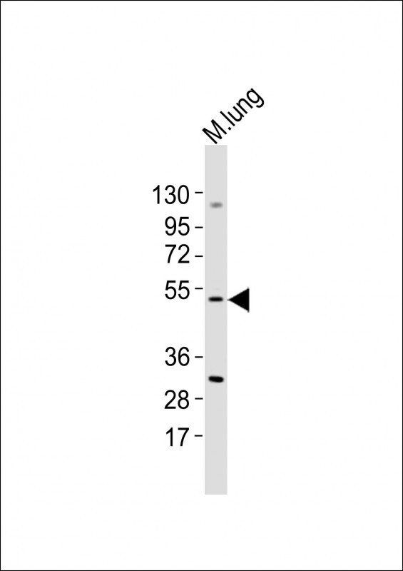 M Mlkl Antibody (C-term)