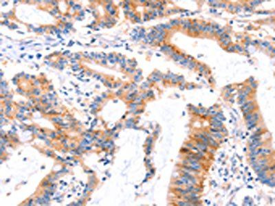 MLLT4 Antibody