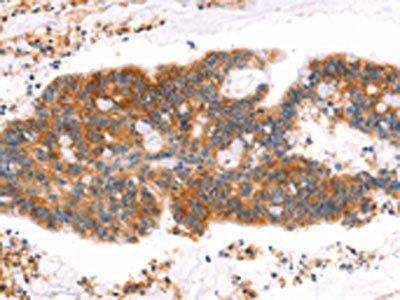 MLLT4 Antibody