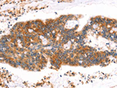 MLLT4 antibody