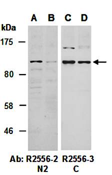 MLXIPL (N2) Antibody, Rabbit Polyclonal