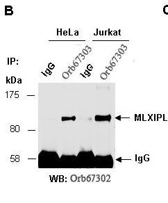 MLXIPL antibody pair