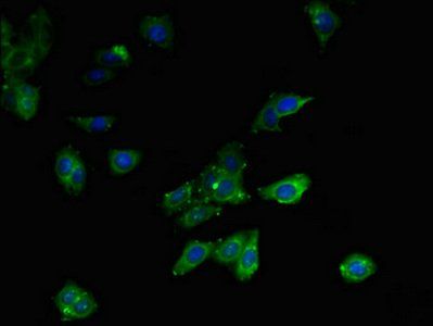 MLYCD Antibody