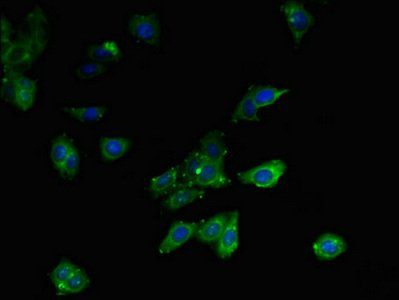 MLYCD antibody