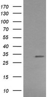 MMACHC Antibody