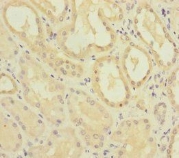 MMACHC Antibody
