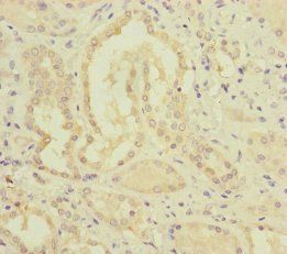 MMACHC Antibody