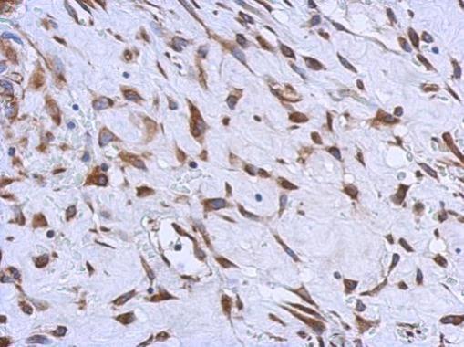 MMACHC antibody [N1C2]