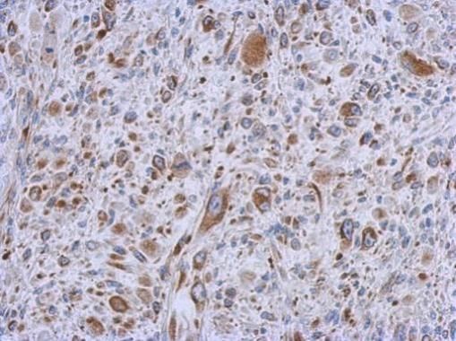 MMACHC antibody [N1C2]