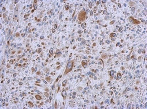 MMACHC antibody