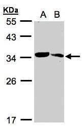 MMACHC antibody [N1C2]