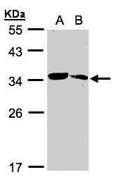 MMACHC antibody