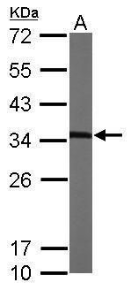 MMACHC antibody [N1C2]