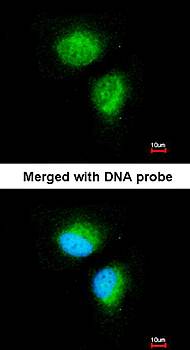 MMACHC antibody