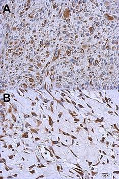 MMACHC antibody