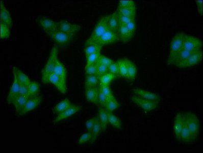 MMADHC antibody