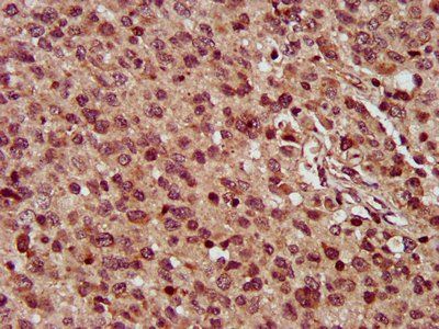 MMADHC Antibody