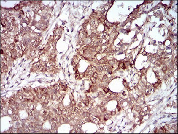 MMEL1 Antibody