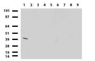 MMGT1 Antibody