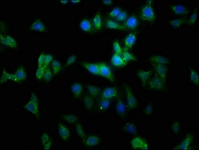 MMGT1 antibody