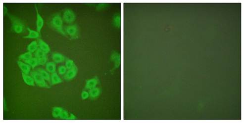 MMP-11 antibody