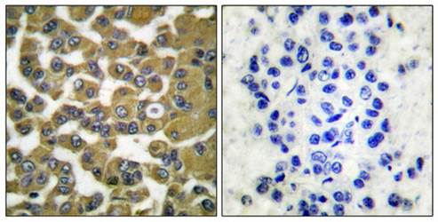 MMP-11 antibody