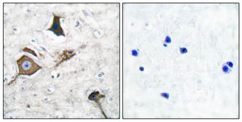 MMP-16 Antibody
