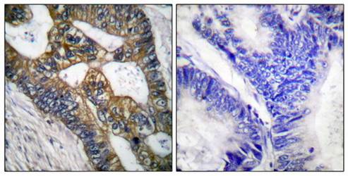 MMP-7 antibody