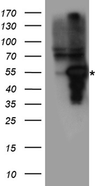 MMP11 Antibody