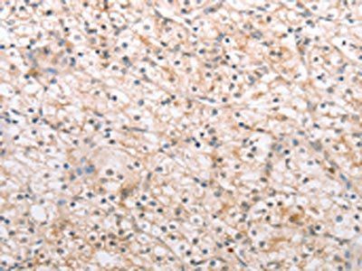 MMP11 Antibody