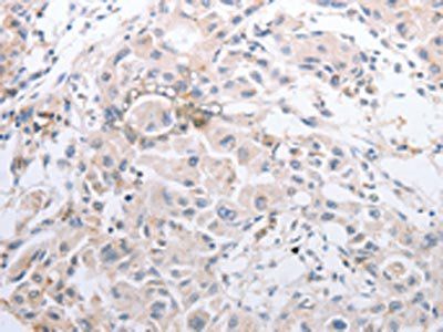 MMP11 Antibody