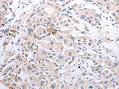 MMP11 antibody