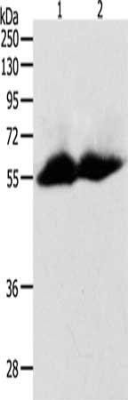 MMP11 antibody