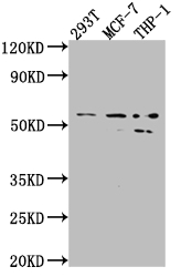 MMP12 Recombinant Monoclonal Antibody