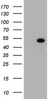 MMP13 Antibody