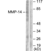 MMP14 antibody